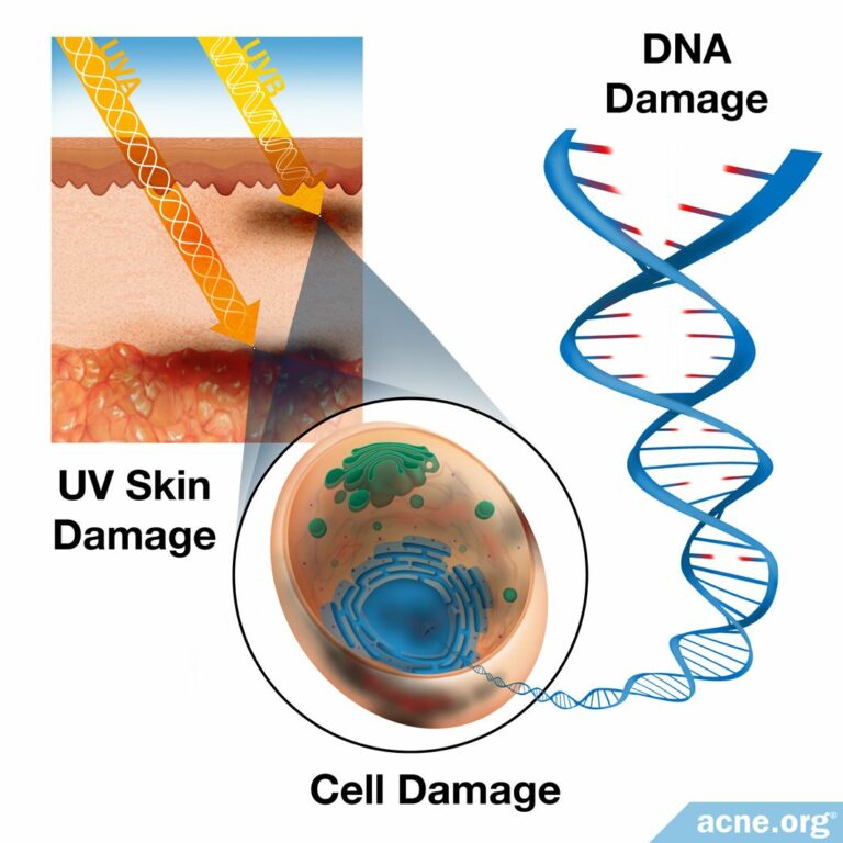 What's The Difference Between UVA And UVB Rays? - Acne.org