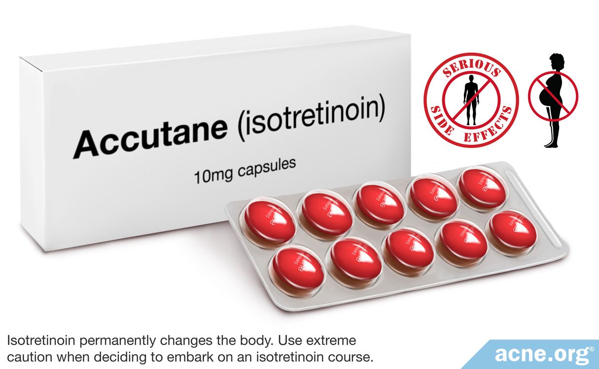 Accutane (Isotretinoin) - Acne.org