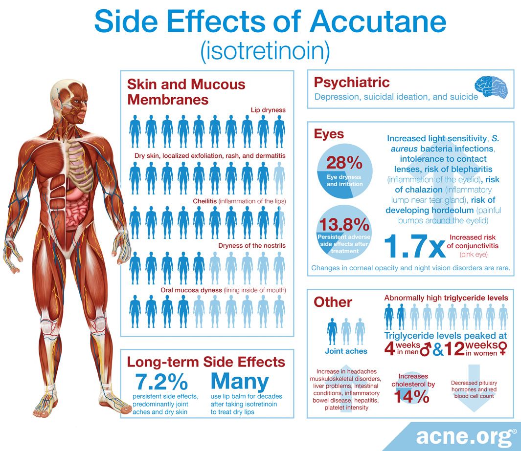 What are the side effects of Accutane (isotretinoin)? - Acne.org