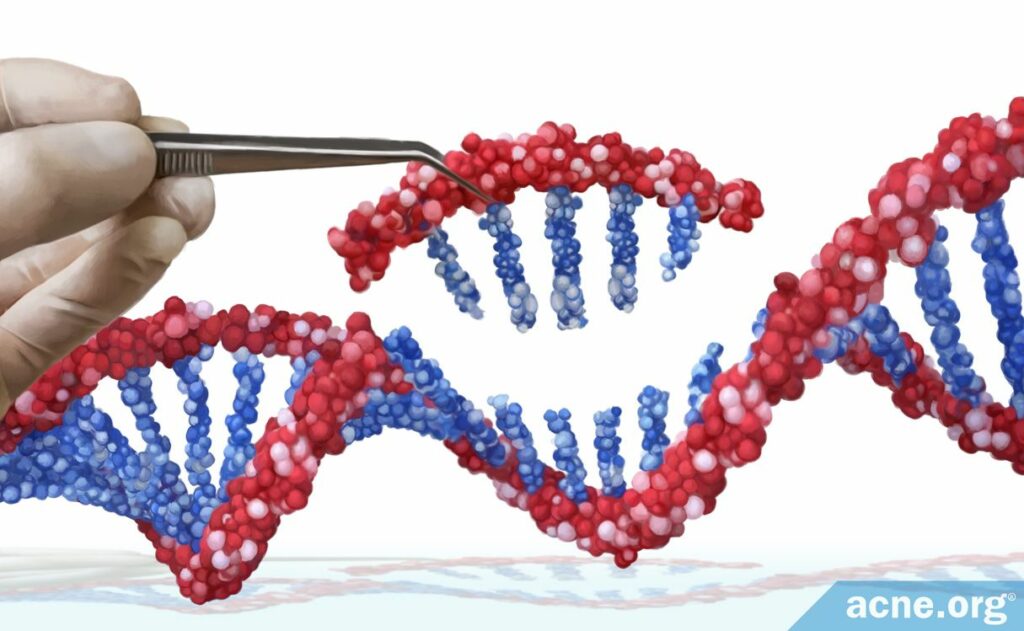 Genetic Treatments for Acne - Acne.org